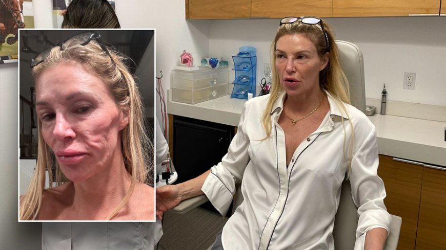 Brandi Glanville thinks parasite attacked face as 'Botched' doc Terry Dubrow calls her 'ticking time bomb'