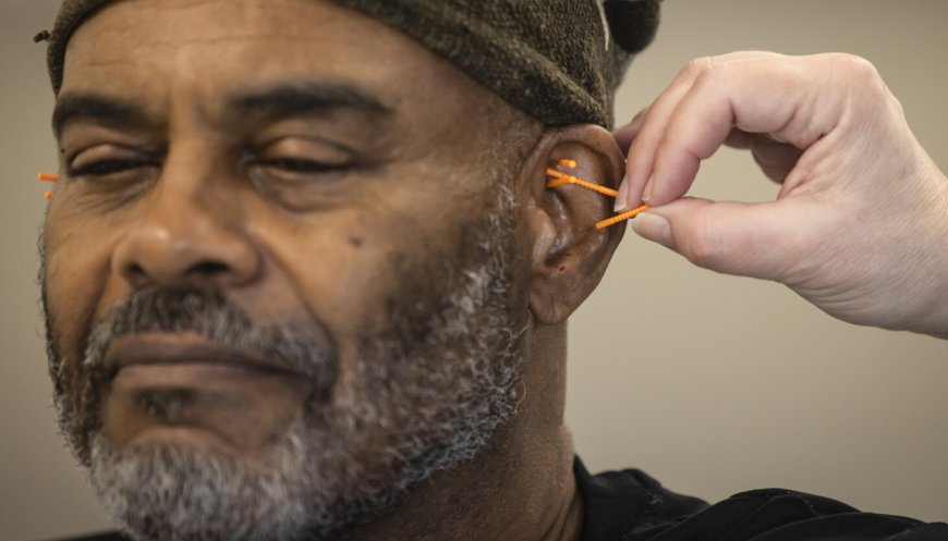 Acupuncture has been used for decades to treat addiction — advocates want to expand its reach
