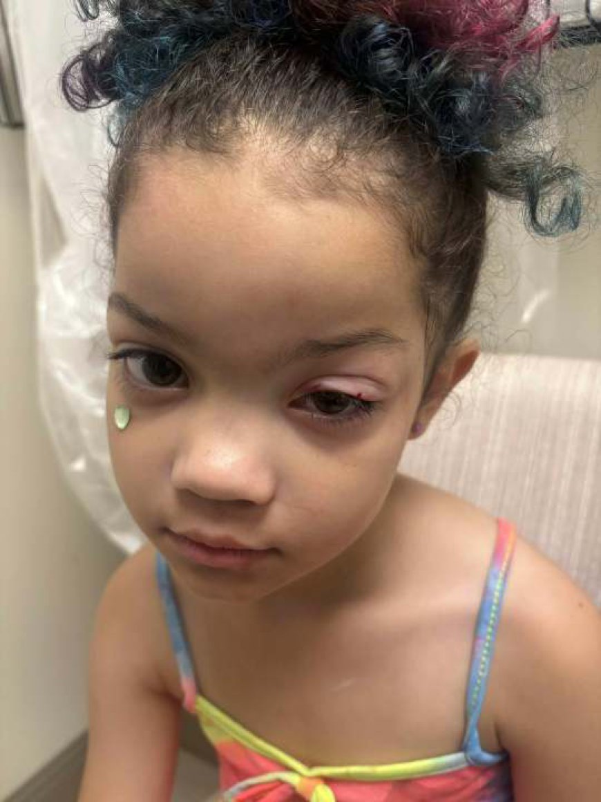 Mother speaking out after child bit by homeless person's dog at Grant Beach Park